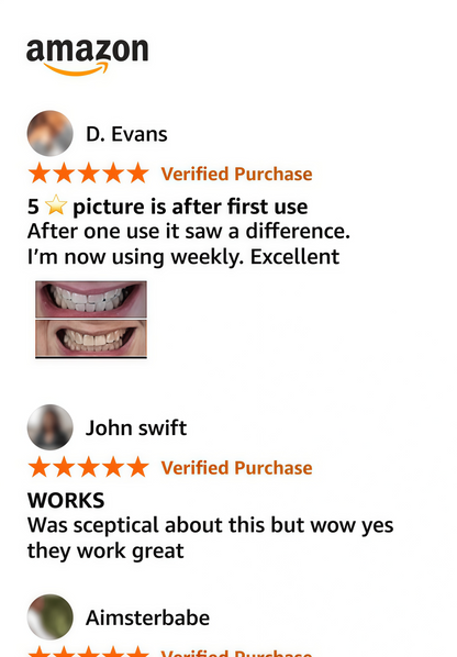 V34 Whitening Strips